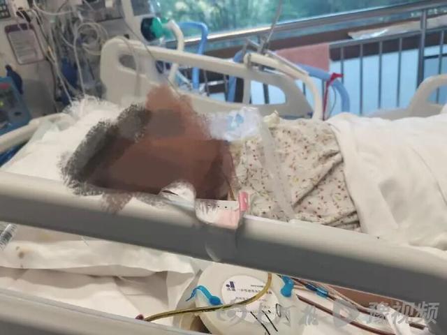 山东45岁产妇心脏骤停，历经52天抢救仍未挽回生命，家属作出回应